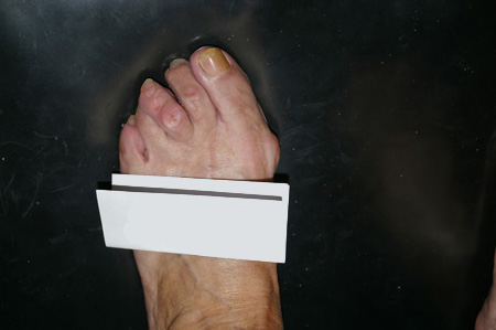 Imatge real pre operat�ria